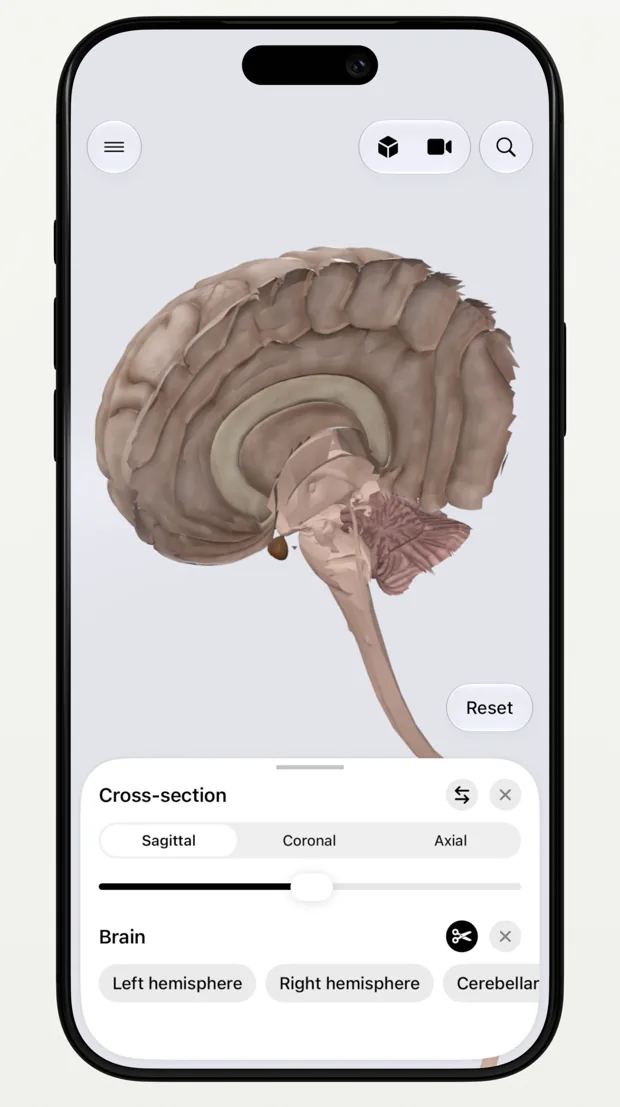 Sagittal cross section of the brain