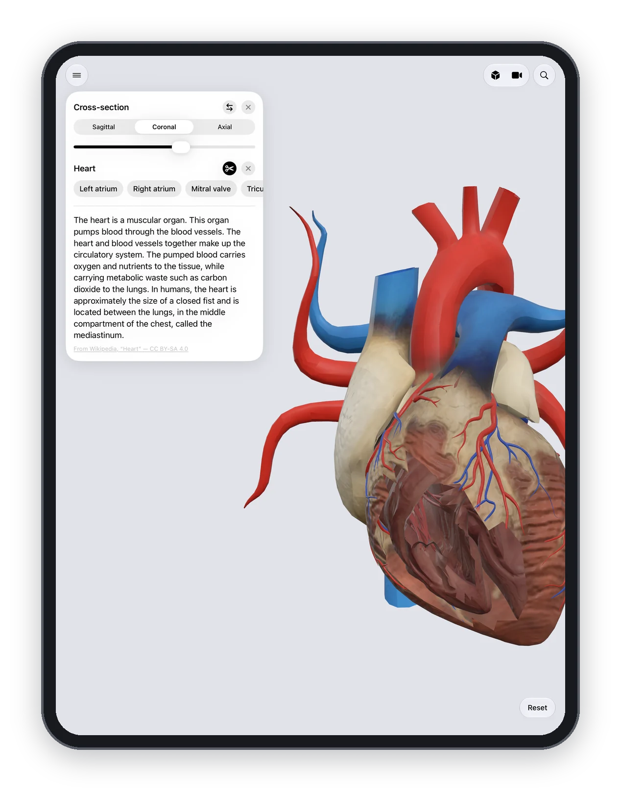 Anatomy Atlas 3D on iPad: a coronal cross section through the heart